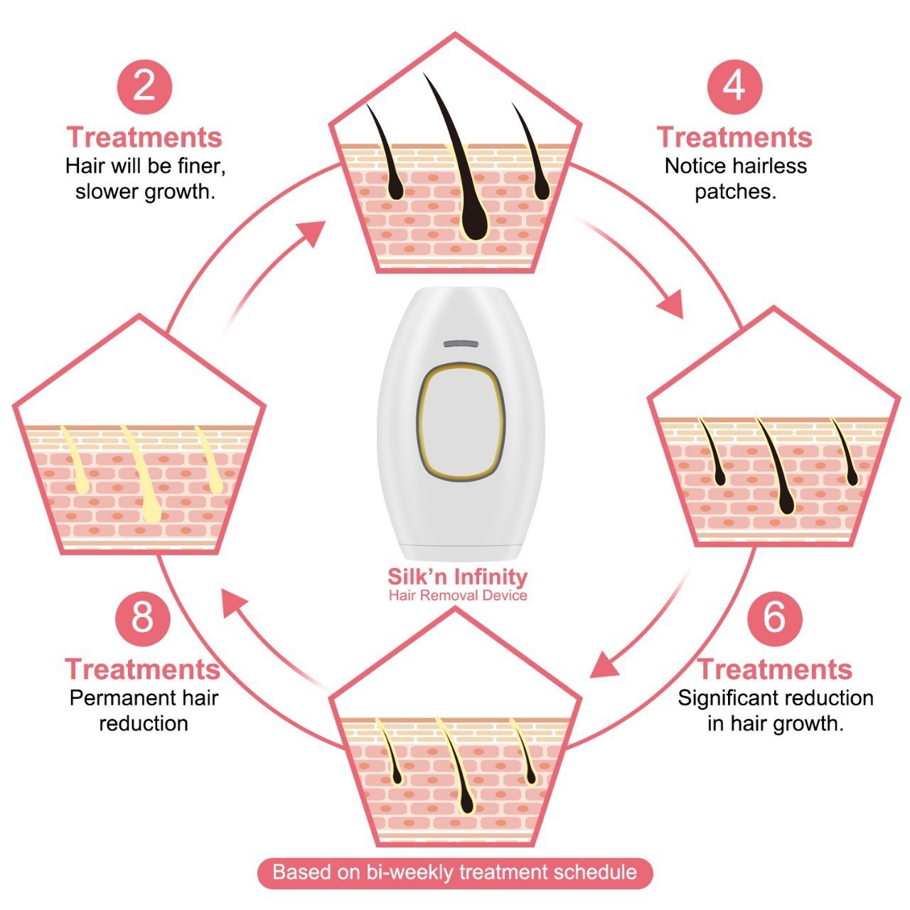 GLOW LASER - PAINLESS LASER HAIR REMOVAL FOR RADIANT , SMOOTH SKIN AT HOME